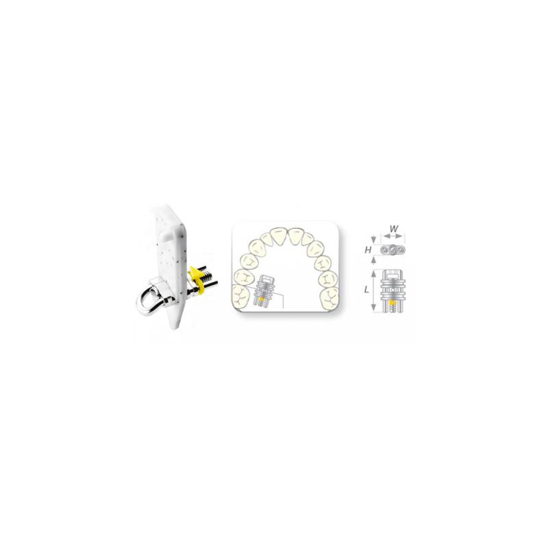 Винт ортодонтический Vector тип 420 (mini сектор.прямой 5,5мм) 2512 купить